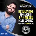 Amazon: Minoxidil 5% tratamiento barba y cabello 60ml
